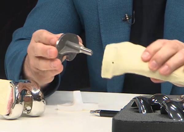 proteza la genunchi ce este si ce presupune operatia