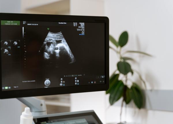 ce este colestaza in sarcina care sunt complicatiile si cum poate fi prevenita