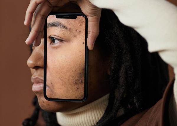 impactul alergiilor asupra pielii care sunt factorii care declanseaza problemele dermatologice