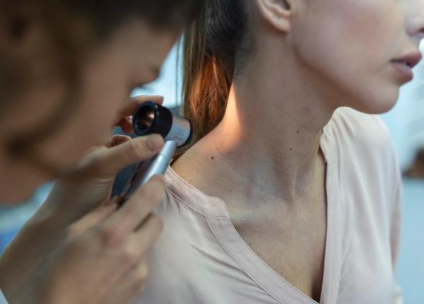 melanomul intarziat cu o peptida cum poate fi tratata cea mai mortala forma de cancer de piele