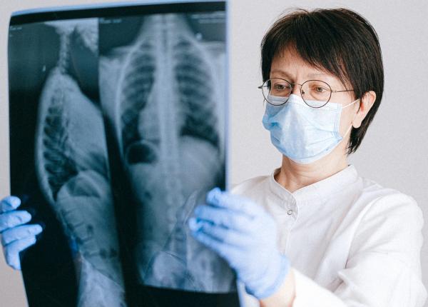 transplantul pulmonar romania tanase tratament cancer