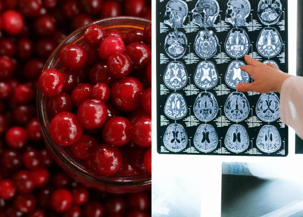 merisoarele imbunatatesc functionarea creierului ce cantitate este indicata