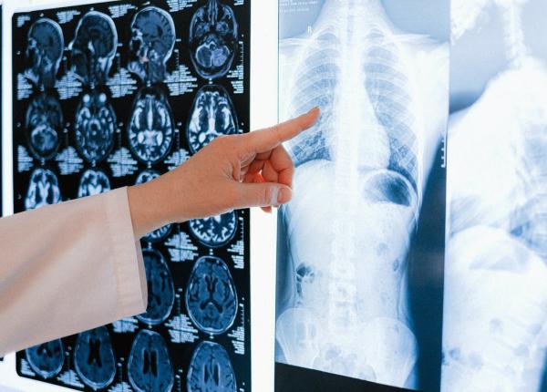 neurotrauma treatment simulation center ntsc dezvolta noi performeri in neurologie