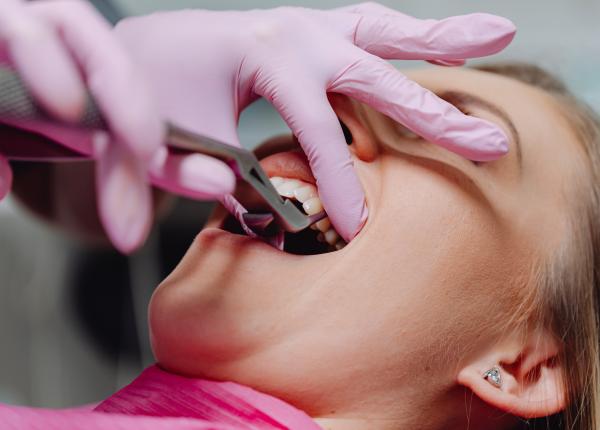 care sunt cele mai daunatoare alimente pentru dinti trebuie sa te feresti de ele gabor real pericol