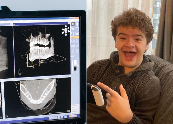 displazia cleidocraniana boala de care sufera actorul gaten matarazzo din stranger things cum se manifesta afectiunea displazia cleidocraniana boala de care sufera actorul gaten matarazzo din stranger things cum se manifesta afectiunea