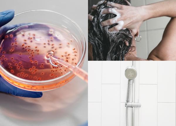 legionella bacteria mortala pe care o poti lua in timpul unui dus la hotel grecia