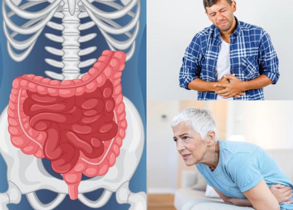 boala inflamatorie intestinala boala civilizatiei de azi negreanu pacienti infectati voit cu oua de tenie dovezi interesante