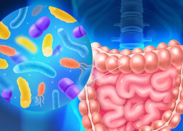 calprotectina testul din scaun care descopera colita ulcerativa ocluzia intestinala boala crohn negreanu complicatii grave colon toxic