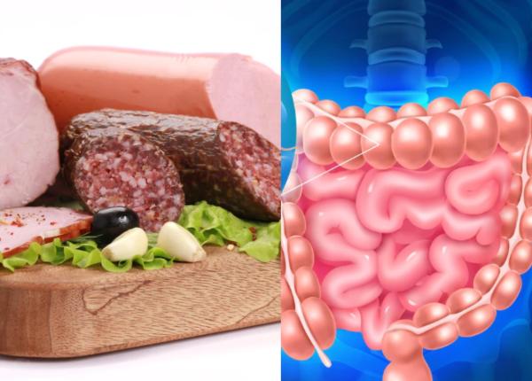 cine e pacientul care face cancer de colon carnea rosie mezeluri