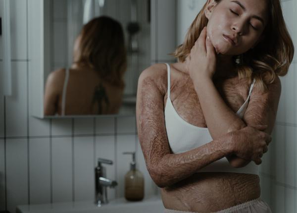 imbatranirea pielii accelerata si de alimente ce sa nu mananci