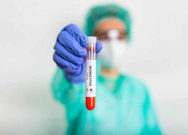 un nou caz de variola maimutei al doilea din tara