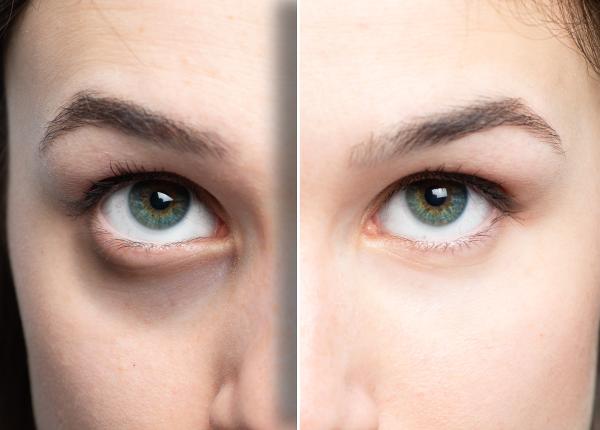 retinolul si retinoizii ingredientul anti imbatranire ioana marinescu