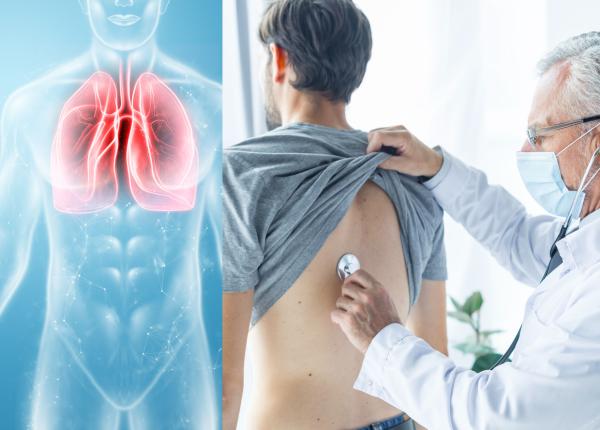 ce este pleurezia sau apa la plamani simptome cauze tratament