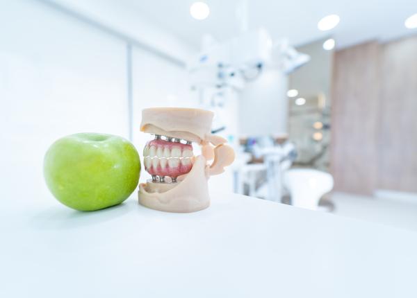 iata cum iti poti schimba dantura si viata cu ajutorul implanturilor dentare p