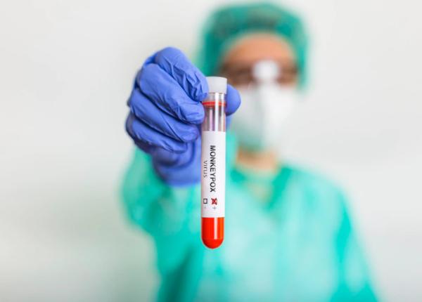 variola maimutei alerta la nivel global oms obiectivul este de a sprijini tarile sa limiteze transmiterea si sa opreasca epidemia