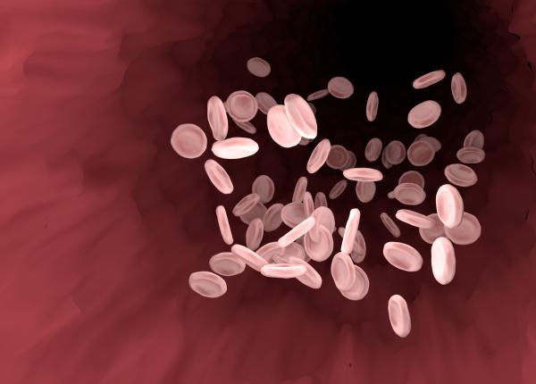 depunerile de calciu de pe vasele de sange nocive medic trebuie sa aveti macar aceeasi grija ca la masina de spalat