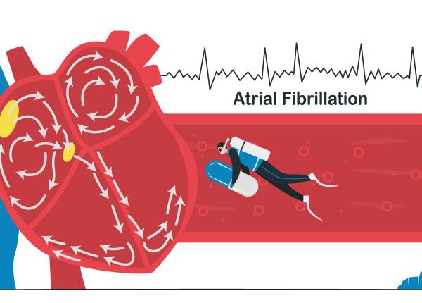fibrilatia atriala avc tratament fibrilatie cristina tiu