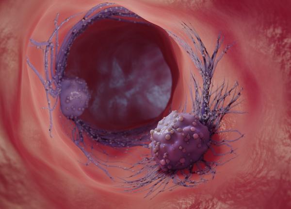 tumorile de doua feluri maligne si benigne care este diferenta intre cele doua