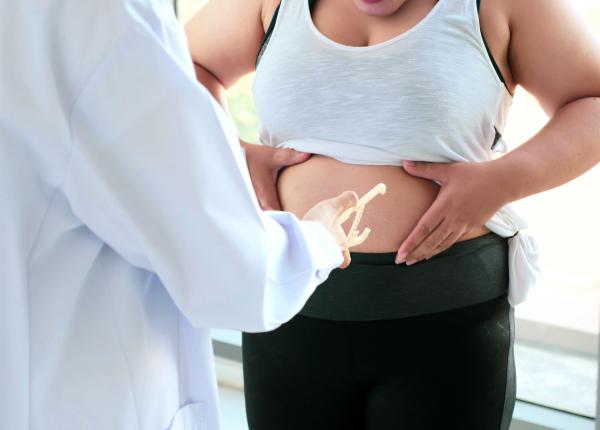 obezitatea boala cronica catalina poiana riscul de cancer este foarte mare