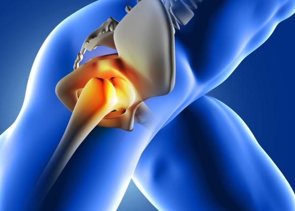 coxartroza specifica varstnicilor dar intalnita si la tineri medic este diagnosticata in momentul in care a devenit o problema de sanatate cronica coxartroza specifica varstnicilor dar intalnita si la tineri medic este diagnosticata in momentul in care a devenit o problema de sanatate cronica