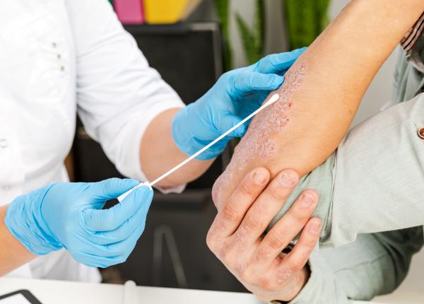 leziunile pielii risc de infectie medic urmariti evolutia ranii periodic pentru a verifica stadiul de vindecare