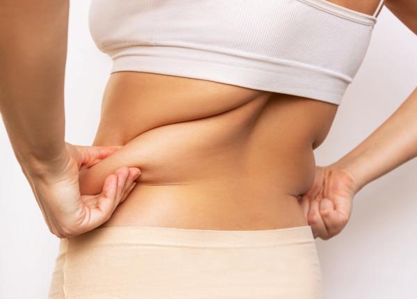 pielea lasata in urma unor diete ioana marinescu este foarte important sa aducem produse care sa stimuleze elasticitatea