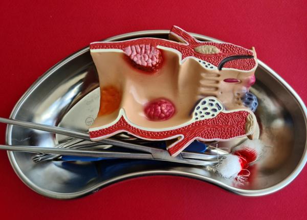 cancerul colorectal tratament modern medic rezultate supravietuire