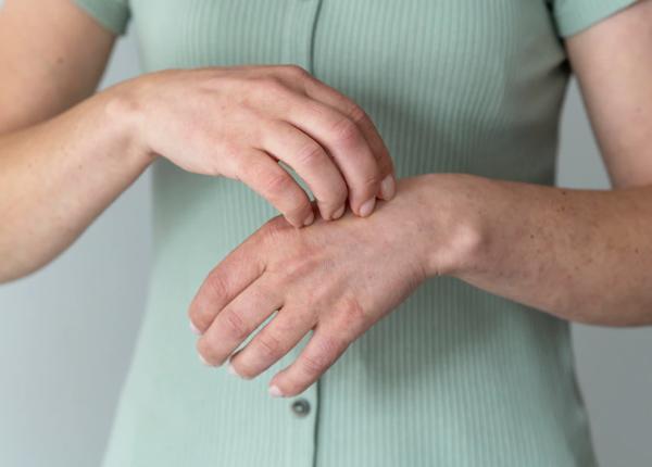 varicela si herpesul factori de risc pentru alzheimer