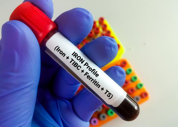 anemia de la cauze la tratament medic dam fier la toata lumea este o greseala fantastica anemia de la cauze la tratament medic dam fier la toata lumea este o greseala fantastica
