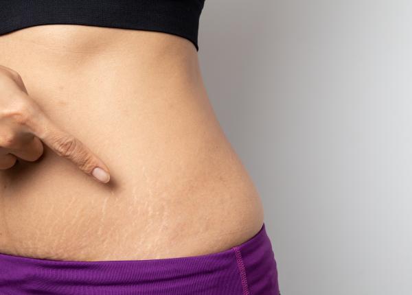 fructul anti vergeturi care elimina grasimea din corp si inhiba pofta de mancare marinescu aratam wow pielea e mult mai tonica lipsita de imperfectiuni