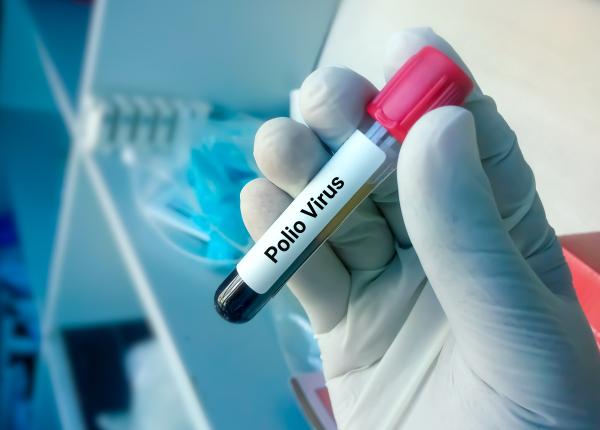 poliomielita prevenita prin vaccinare tamara rosu poliomielita prevenita prin vaccinare tamara rosu