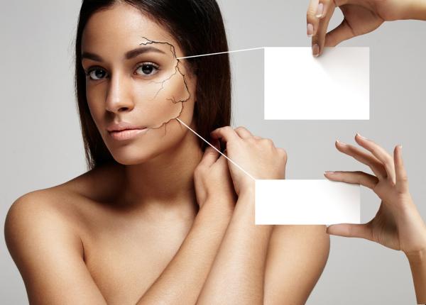 pielea uscata afectiunile pe care le poate ascunde care este tratamentul