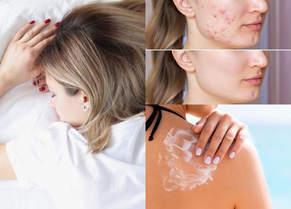 mituri despre ingrijirea tenului demontate pasta de dinti nu vindeca acneea tenul gras are nevoie de hidratare