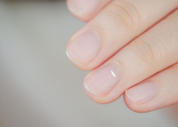 petele de pe unghii cauze si remedii ce se ascunde in spatele acestora