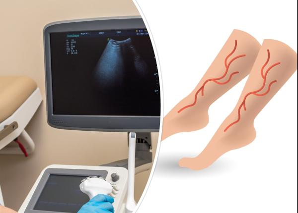 ecografia vasculara doppler procedura non invaziva asupra vaselor de sange medic permite intelegerea structurii si a functiilor inimii