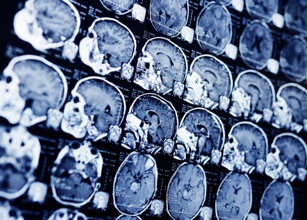 care este legatura dintre sanatatea inimii si varsta creierului femeile mai tinere decat barbatii