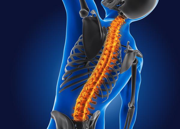 hernie de disc operatie cage gramescu maduva spinarii