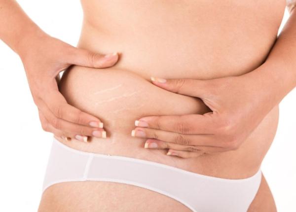 ulei de corp impotriva vergeturilor reteta facuta in casa