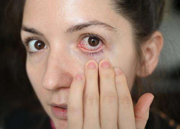 corp strain in ochi cum sa il indepartezi cand e cazul sa te vada un oftalmolog