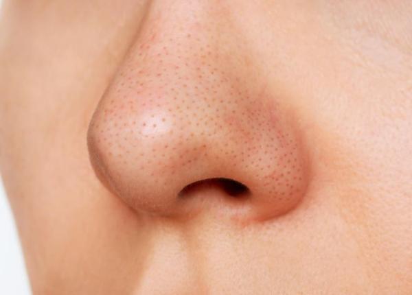 punctele negre doua ingrediente din bucatarie