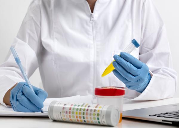 urina galbena sau verde ce o determina si ce afectiuni se pot ascunde