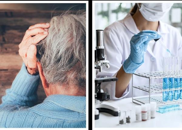 alzheimer diagnostic prin analize de sange cum se procedeaza alzheimer diagnostic prin analize de sange cum se procedeaza