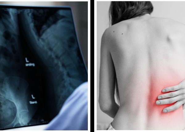 osteoporoza testul de 10 minute care iti arata gradul de afectare al oaselor medic nu se vindeca ci poate fi tinuta sub control osteoporoza testul de 10 minute care iti arata gradul de afectare al oaselor medic nu se vindeca ci poate fi tinuta sub control