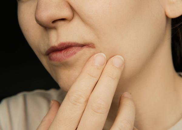 crapaturile la coltul gurii asociate cu hiperglicemia si carenta de vitamine cum poti scapa de ele