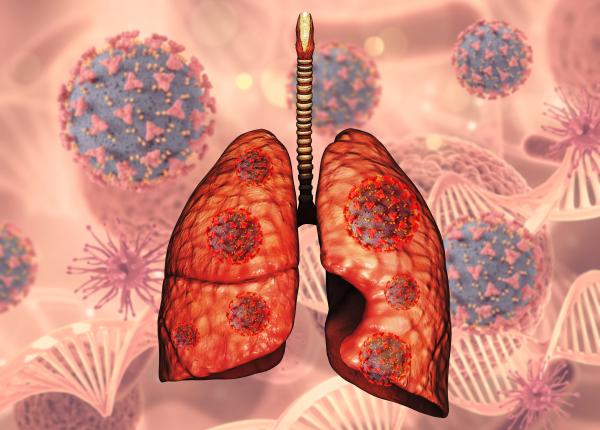 abcesul pulmonar dificil de tratat medic poate pune viata in pericol