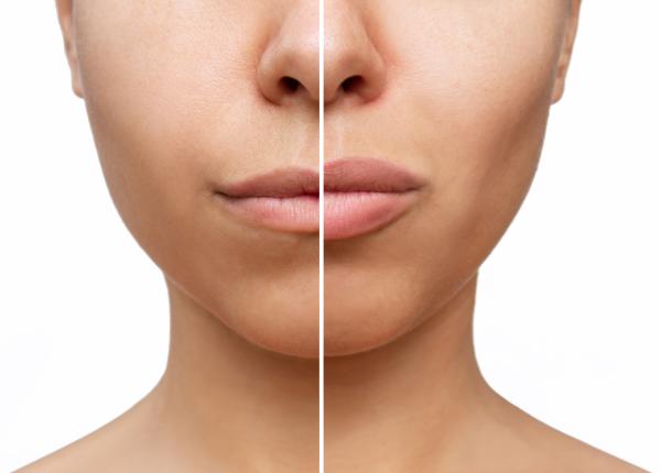 cum sa dai volum buzelor natural trucuri buze mari