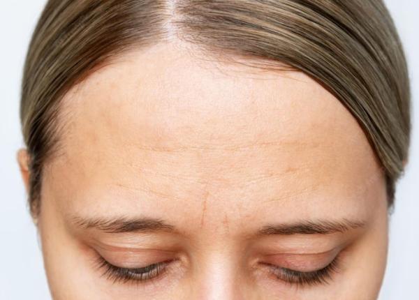 alimentul care provoaca imbatranirea prematura a tenului