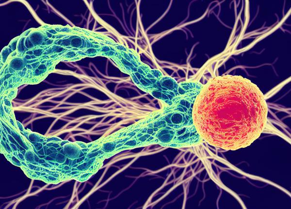 metastazele cauze si tratament medic daca in trecut reprezentau un capat de drum acum exista sperante