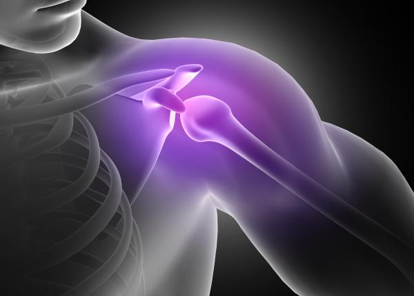 proteza de umar sansa pentru o viata fara dureri medic suntem foarte in urma cu aceasta interventie