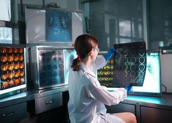 metastazele cerebrale de ce apar si cum se elimina care sunt primele semne ciurea sunt foarte periculoase pentru organism